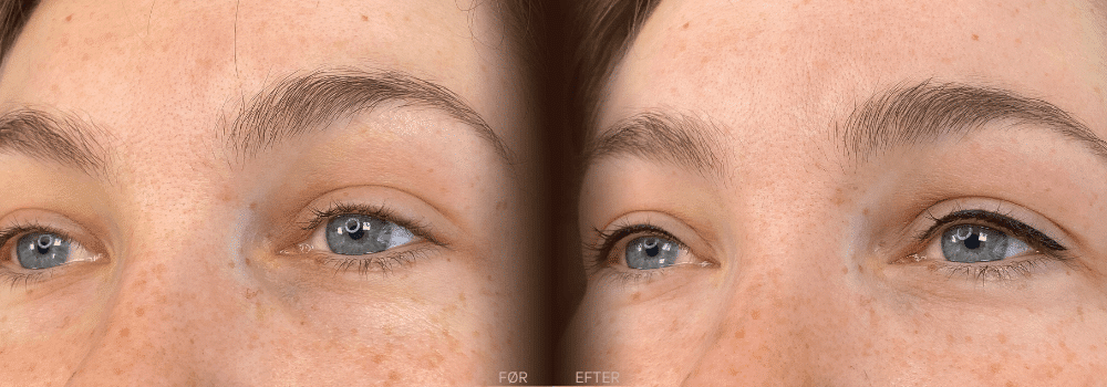 Permanent eyeliner før og efter med vingeeffekt – fremhævelse af blå øjne