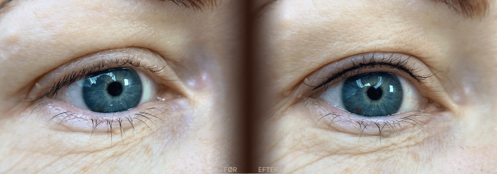 Før og efter billede af naturlig permanent vippefortætning